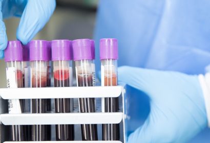 La biotech Amadix recibe un préstamo de 15 millones de euros del BEI
