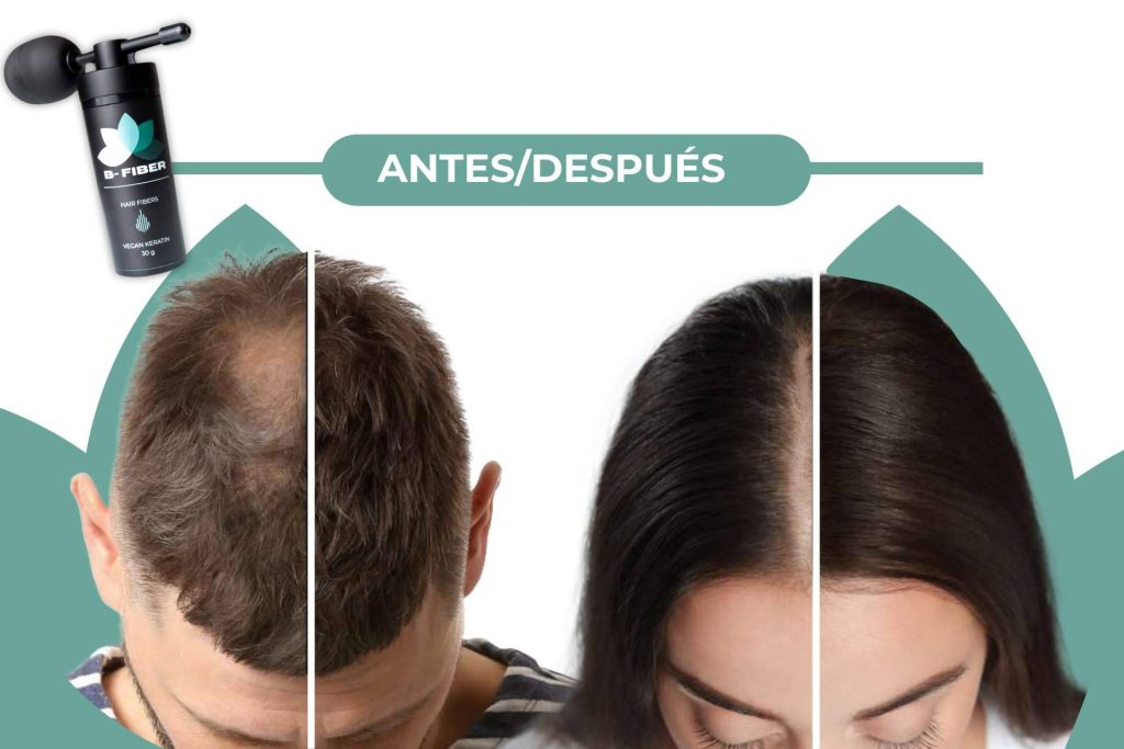BFIBER; La alternativa efectiva para la pérdida de cabello