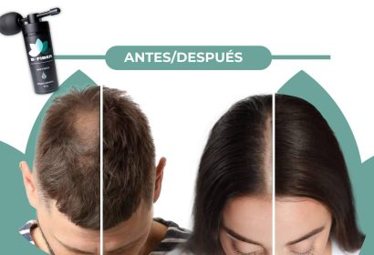 BFIBER; La alternativa efectiva para la pérdida de cabello