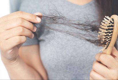 Alopecia androgénica soluciones efectivas; cuidando el cabello y autoestima