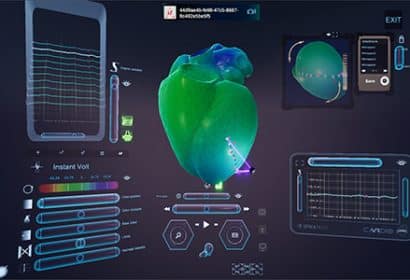 La herramienta de Spika Tech permite al médico explorar el corazón como si estuviese dentro