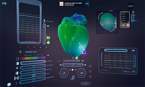 La herramienta de Spika Tech permite al médico explorar el corazón como si estuviese dentro