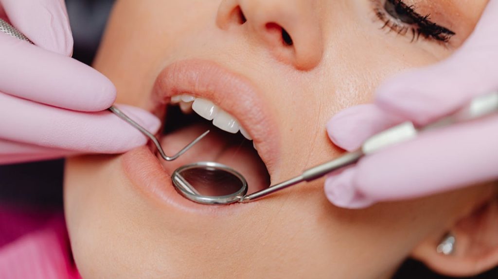 ¿Qué es una franquicia dental? 5 franquicias de clínicas dentales en España