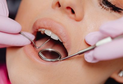 ¿Qué es una franquicia dental? 5 franquicias de clínicas dentales en España